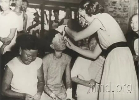 孙理莲亲手服事麻风病人